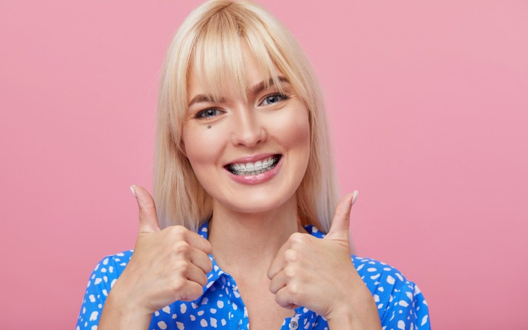 What You Need to Know About Nickel free Braces 1080×675 1 What You Need to Know About Nickel free Braces 1080x675 1