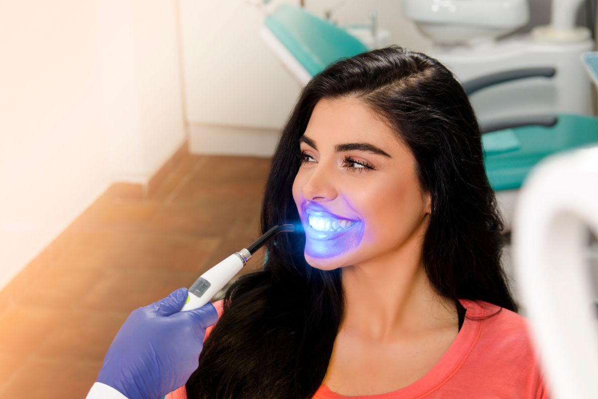 Should You Get Professional Whitening